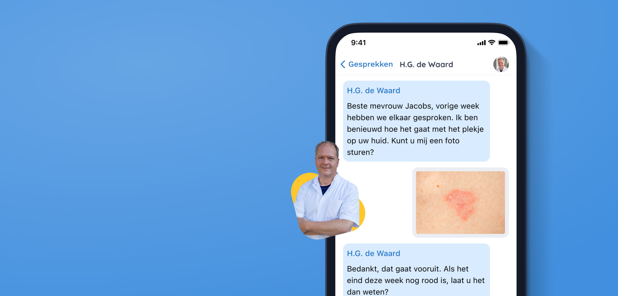 Gesprek over plekje op huid via de BeterDichtbij app.